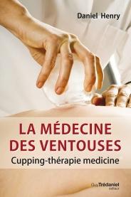 La médecine des ventouses